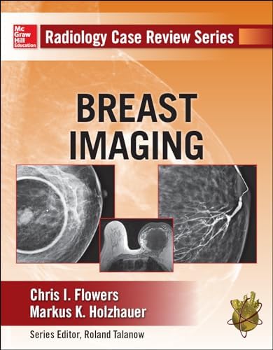 Diagnostic Imaging: Breast: 9781931884730: Medicine & Health